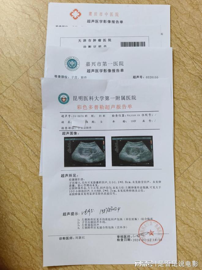 最新确诊病假，理解、处理与关怀的重要性